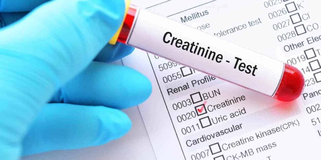 how to lover creatinine levels for CKD, lowering creatinine naturally renal function, how to lover cretinine for chronic kidney disease