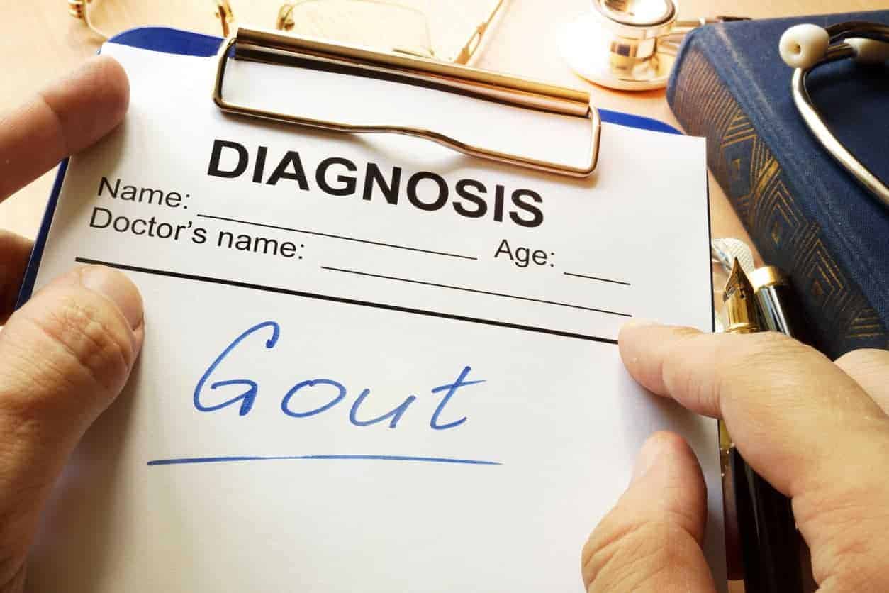 Gout, natural remedies for gout, gout and CKD, gout and renal function, treatment gout, prevent gout, kidney disease gout