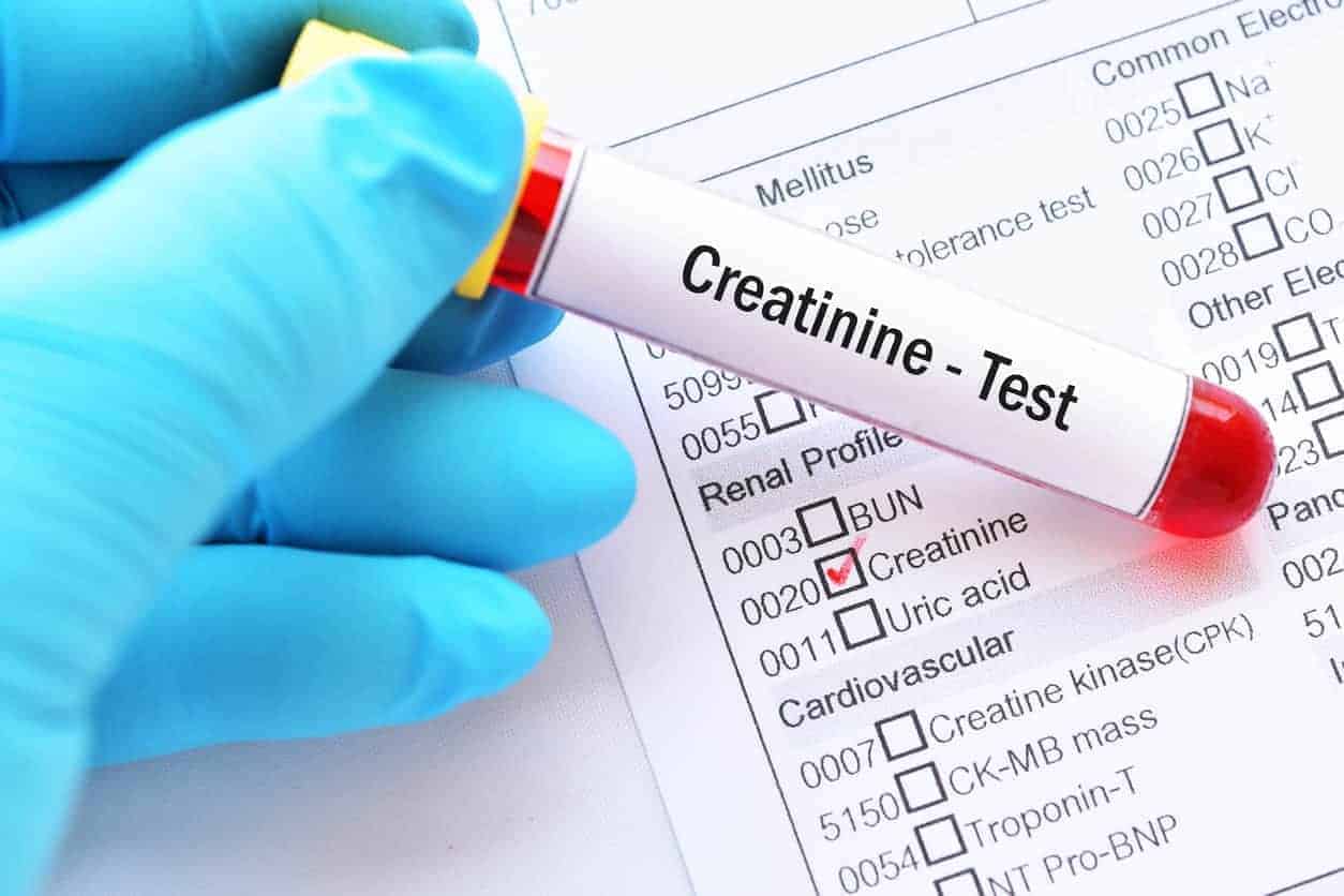 how to lover creatinine levels for CKD, lowering creatinine naturally renal function, how to lover cretinine for chronic kidney disease